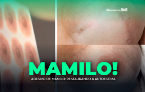 Adesivo de Mamilo: Restaurando a Autoestima