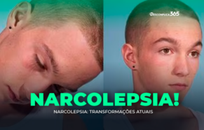 Narcolepsia: Transformações atuais